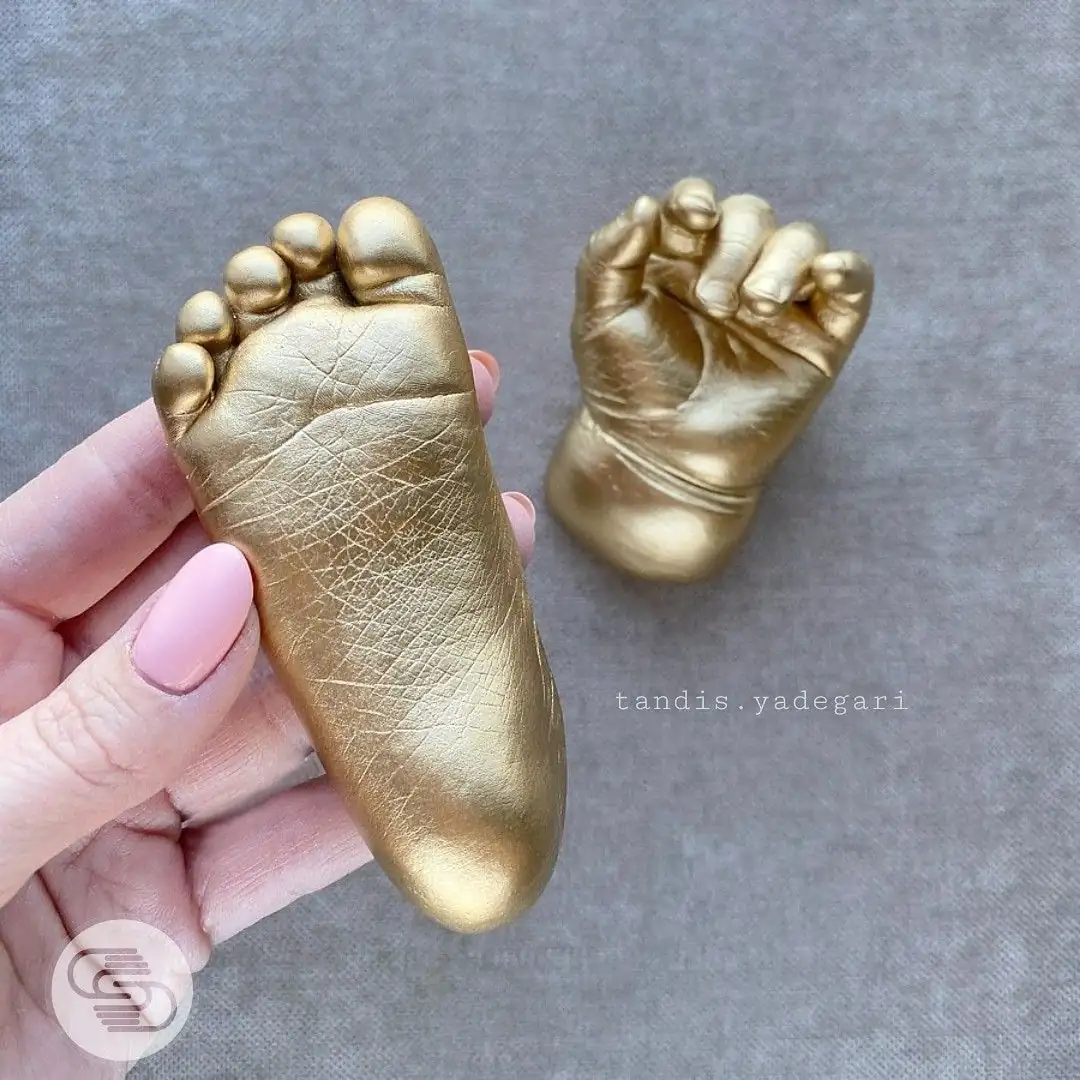 Hand & Feet Casting Hamirpur